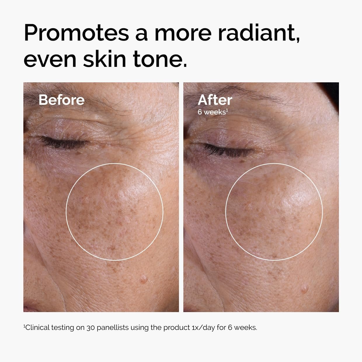 The Ordinary Glycolic Acid 7% Exfoliating Toner, Brightening and Smoothing Daily Toner for More Even-Looking Skin Tone, 8.1 Fl Oz - Image 2