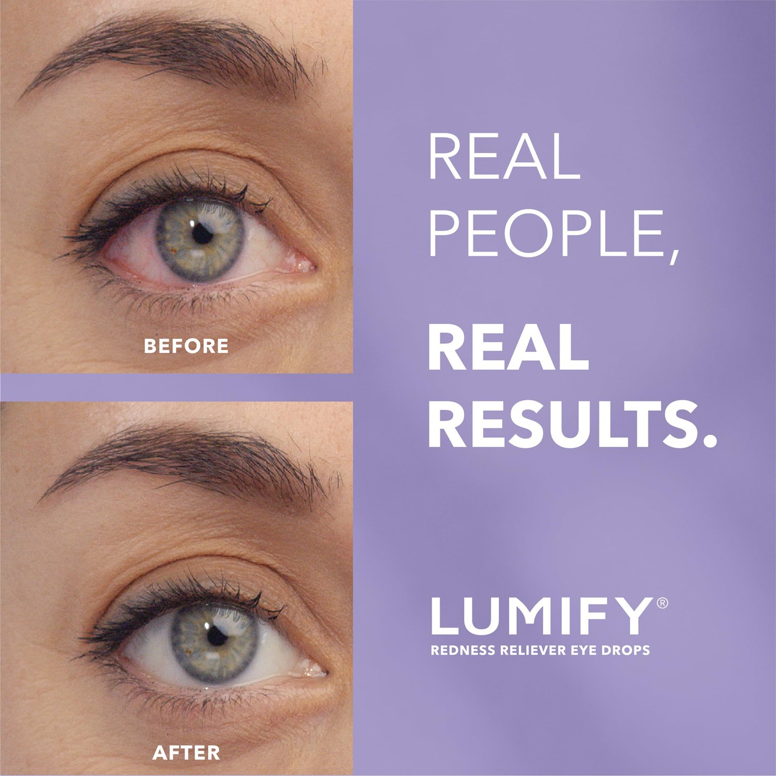 Lumify Redness Relief Eye Drops, Whiter & Brighter Looking Eyes, 0.17 oz - Image 2